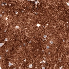Immunohistochemical staining of human cerebral cortex shows strong positivity in neuropil.