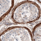 Immunohistochemical staining of human testis shows strong positivity in the lamina propria.