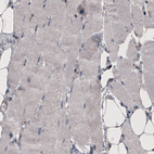 Immunohistochemical staining of human skeletal muscle shows absence of immunoreactivity (negative control).