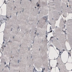 Immunohistochemical staining of human skeletal muscle shows absence of immunoreactivity (negative control).