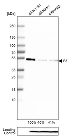Western blot analysis in A-431 cells transfected with control siRNA, target specific siRNA probe #1 and #2, using Anti-F3 antibody. Remaining relative intensity is presented. Loading control: Anti-PPIB.