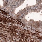 Anti-ACTB Antibody