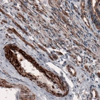 Immunohistochemical staining of human fallopian tube shows immunoreactivity in smooth muscle cells of blood vessels and connective tissue.