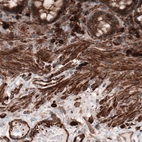 Immunohistochemical staining of human colon shows positivity in smooth muscle, lymphoid and glandular cells.