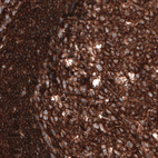 Immunohistochemical staining of human tonsil shows strong positivity in lymphoid cells.