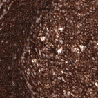 Immunohistochemical staining of human tonsil shows strong positivity in lymphoid cells.