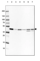 Lane 1: Marker [kDa] 250, 130, 100, 70, 55, 35, 25, 15, 10_br/_Lane 2: Human cell line HeLa_br/_Lane 3: Human cell line HEK 293_br/_Lane 4: Human cell line A-431_br/_Lane 5: Human cell line HepG2_br/_Lane 6: Mouse cell line NIH-3T3_br/_Lane 7: Rat cell line NBT-II