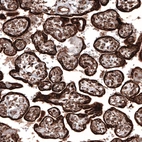 Immunohistochemical staining of human placenta shows strong cytoplasmic positivity in trophoblastic cells.
