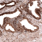 Immunohistochemical staining of human prostate shows strong cytoplasmic positivity in glandular cells.