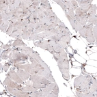 Immunohistochemical staining of human skeletal muscle shows negative to very weak cytoplasmic positivity in myocytes.