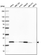 Anti-PPIB Antibody