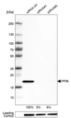 Western blot analysis in U-251MG cells transfected with control siRNA, target specific siRNA probe #1 and #2, using Anti-PPIB antibody. Remaining relative intensity is presented. Loading control: Anti-GAPDH.