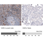 Anti-VSIR Antibody