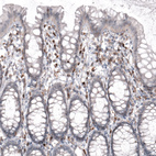 Immunohistochemical staining of human rectum shows moderate to strong cytoplasmic positivity in lymphoid cells.