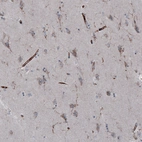 Immunohistochemical staining of human cerebral cortex shows positivity in a subset of cells and blood vessels.