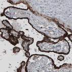 Immunohistochemical staining of human placenta shows strong cytoplasmic immunoreactivity in trophoblast.