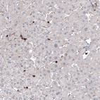 Immunohistochemical staining of human liver shows strong positivity in a subset of lymphoid cells.