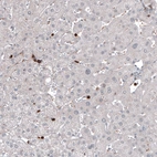 Immunohistochemical staining of human liver shows strong positivity in a subset of lymphoid cells.