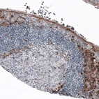 Immunohistochemical staining of human tonsil shows immunoreactivity in a subset of lymphoid and epithelial cells.