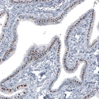 Immunohistochemical staining of human fallopian tube shows moderate to strong nuclear positivity in glandular cells.