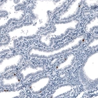 Immunohistochemical staining of human endometrium shows strong nuclear positivity in a subset of glandular cells.