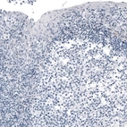 Immunohistochemical staining of human tonsil shows no positivity in germinal center cells as expected.