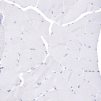 Immunohistochemical staining of human skeletal muscle shows no positivity in myocytes as expected.