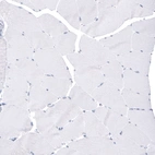 Immunohistochemical staining of human skeletal muscle shows no positivity in myocytes as expected.