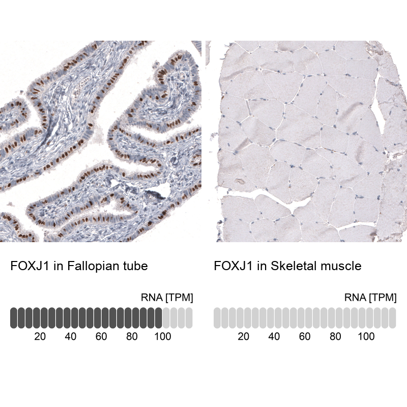 Anti-FOXJ1 Antibody
