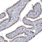 Immunohistochemical staining of human fallopian tube shows moderate to strong nuclear positivity in glandular cells.