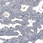 Anti-FOXJ1 Antibody