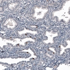 Immunohistochemical staining of human endometrium shows strong nuclear positivity in a subset of glandular cells.