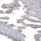 Immunohistochemical staining of human prostate shows no positivity in glandular cells as expected.