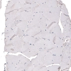 Immunohistochemical staining of human skeletal muscle shows no positivity in myocytes as expected.