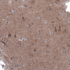 Anti-BRAF Antibody