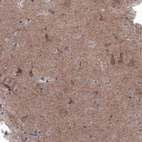 Immunohistochemical staining of human cerebral cortex shows moderate positivity in neuropil and cytoplasmic staining in some neurons.
