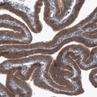 Immunohistochemical staining of human fallopian tube shows strong cytoplasmic immunoreactivity in glandular cells.