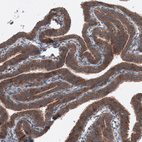 Immunohistochemical staining of human fallopian tube shows strong cytoplasmic positivity in glandular cells.