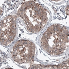 Immunohistochemical staining of human testis shows cytoplasmic positivity in seminiferous tubules.