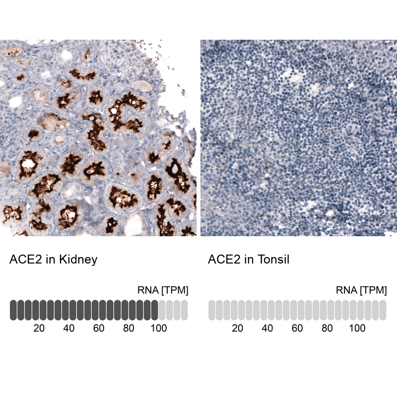 Anti-ACE2 Antibody