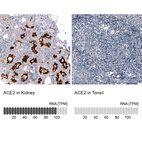 Anti-ACE2 Antibody