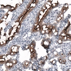 Immunohistochemical staining of human small intestine shows strong positivity in apical membrane in glandular cells.