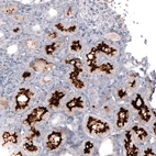 Immunohistochemical staining of human kidney shows strong positivity in apical membrane in cells in proximal tubules.