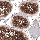 Immunohistochemical staining of human testis shows strong membranous positivity in cells in seminiferous ducts.