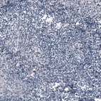 Immunohistochemical staining of human tonsil shows no positivity in non-germinal center cells as expected.