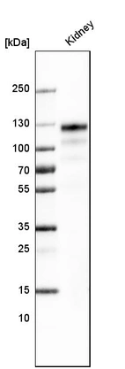 Western blot analysis in human kidney tissue.