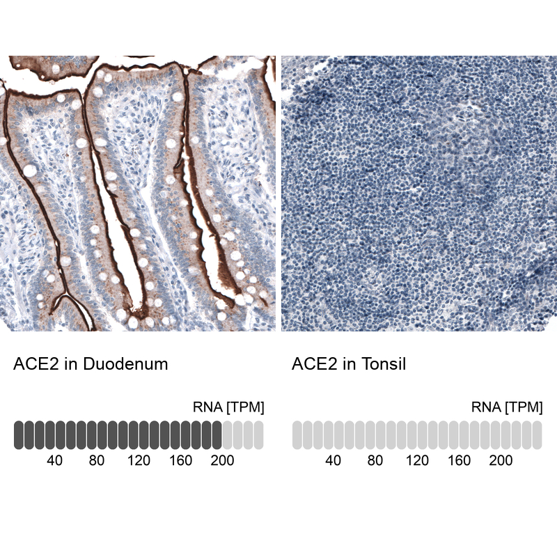 Anti-ACE2 Antibody