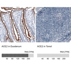 Anti-ACE2 Antibody