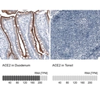 Anti-ACE2 Antibody