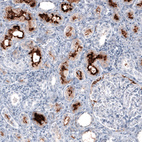 Immunohistochemical staining of human kidney shows strong positivity in apical membrane in cells in proximal tubules.